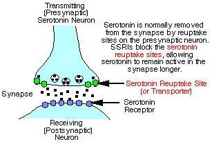 can ssri cause ocd